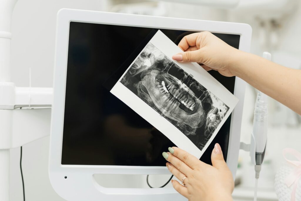 the dentist holds in his hands an X-ray examination of the oral cavity,